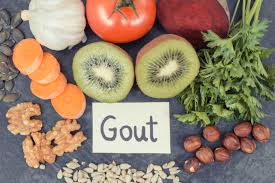 Get Ahead of Gout Pain