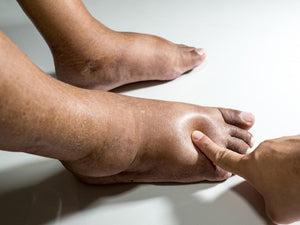 10 Footcare Tips For People With Diabetes