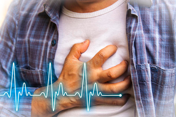 What is a Heart Attack or  Myocardial Infarction?